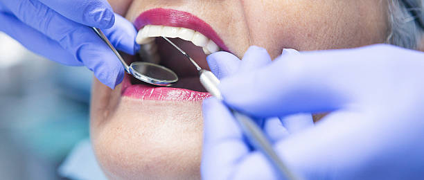 Best Emergency Wisdom Teeth Removal in Samson, AL
