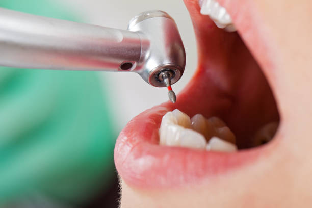 Best Emergency Denture Repair in Samson, AL
